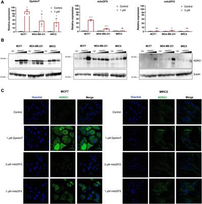 NDRG1 acts as an oncogene in triple-negative breast cancer and its loss sensitizes cells to mitochondrial iron chelation